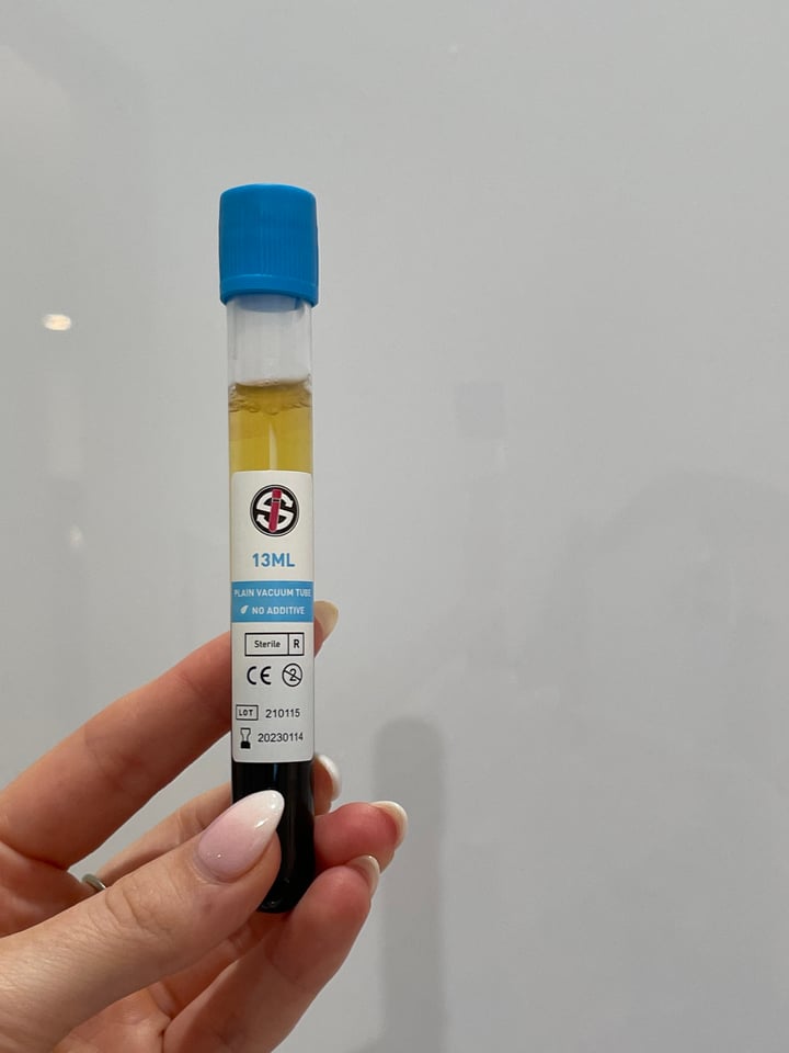 A Detailed Guide On What To Do After PRP Injection