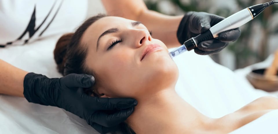 Understanding The SkinPen Microneedling Benefits