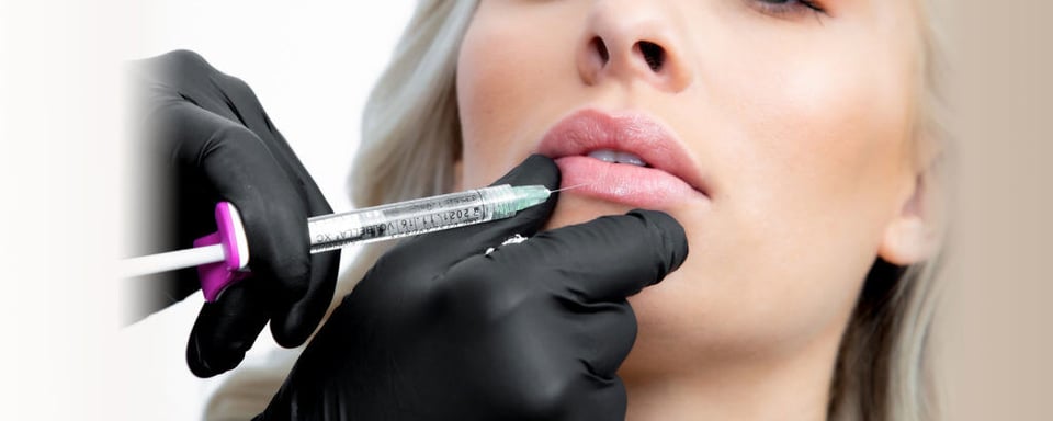 ​​Does Lip Filler Dissolve On Its Own? Exploring Natural Dissolution